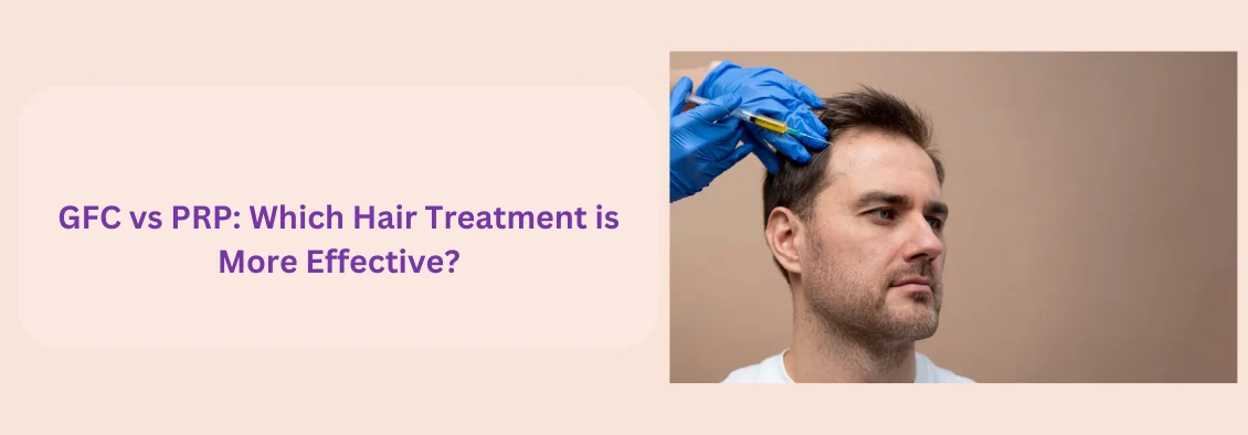 GFC Hair Treatment Cost in Bangalore