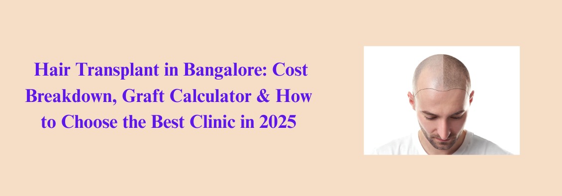 Hair Transplant in Bangalore | Cost, Graft Calculator & Best Clinics