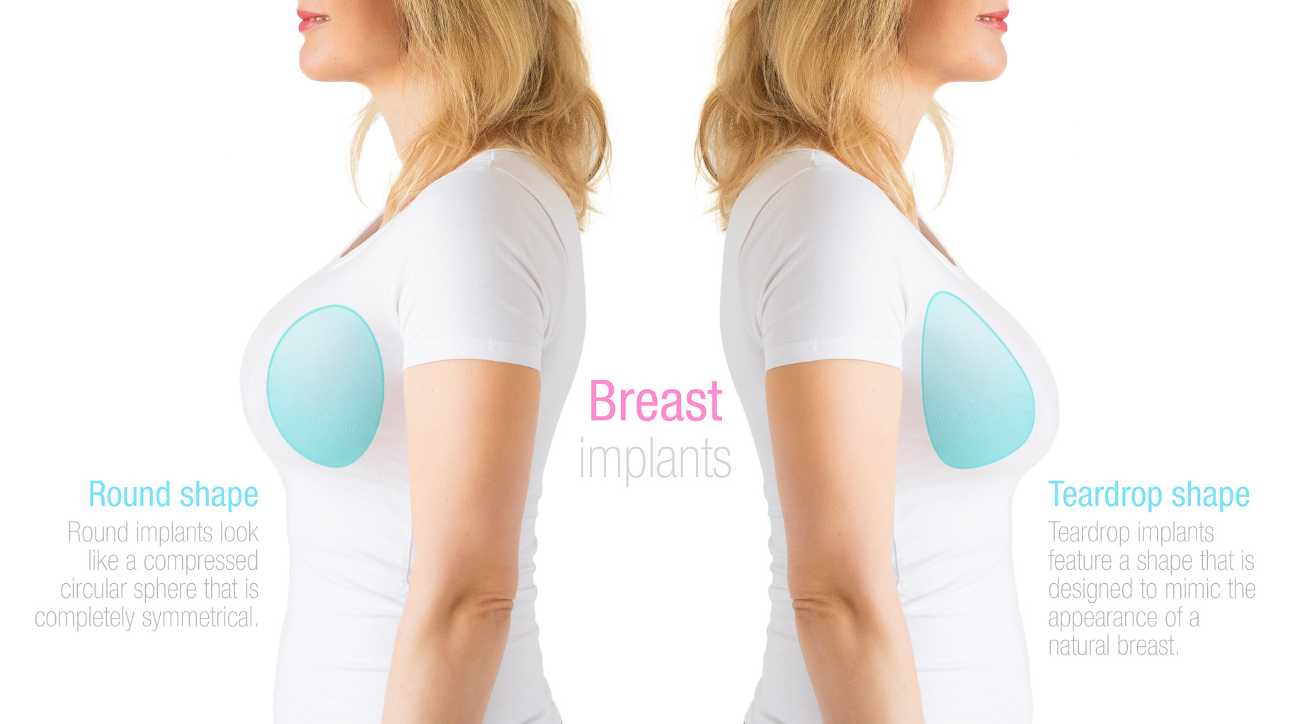 Breast Enlargement Surgery in Bangalore