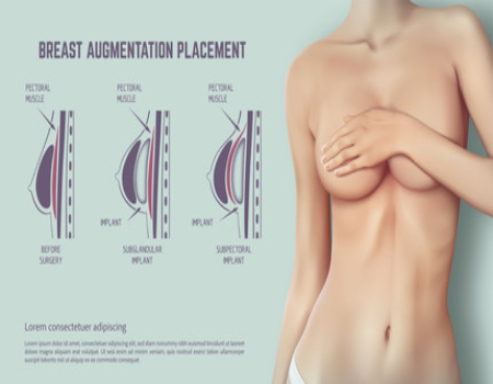 Breast Implant Cost in Bangalore - LivGlam Clinic
