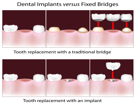 Cosmetic Dentistry