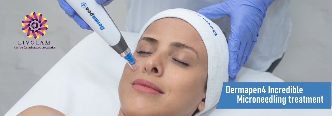 Dermapen treatment