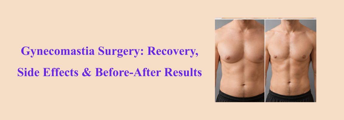 Gynecomastia Surgery: Recovery, Side Effects & Before-After Results