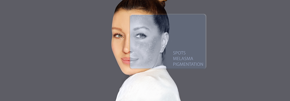 melsa and pigmentation