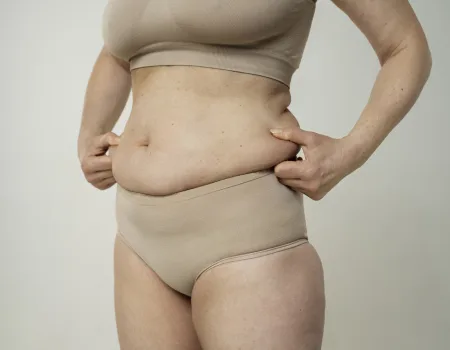 premium tummy tuck in Bangalore.