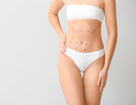 Tummy Tuck Cost in Bangalore - Premium Results