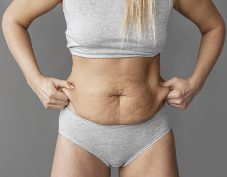 Tummy Tuck Surgery in Bangalore - Premium Results and Competitive Pricing