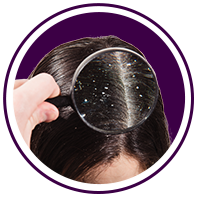 Dandruff Service