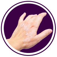 Peeling skin Service